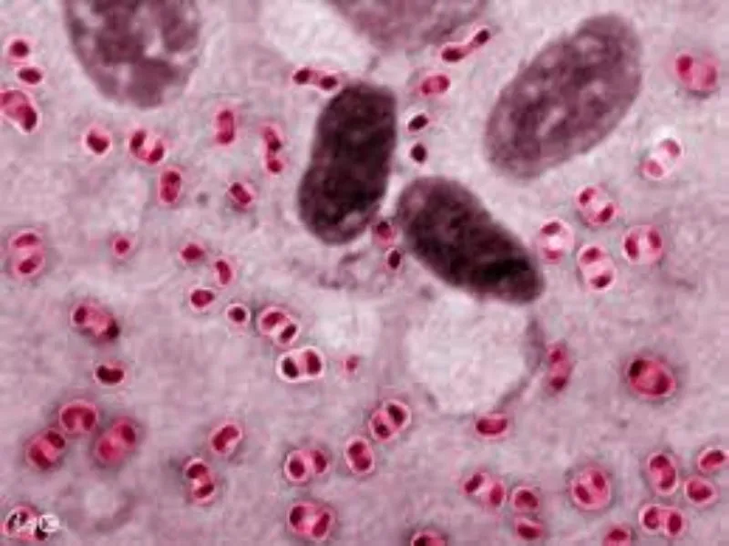 Pasteurella multocida là virus gây ra bệnh tụ huyết trùng ở gà đá 